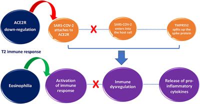 An Overview of Asthma and COVID-19: Protective Factors Against SARS-COV-2 in Pediatric Patients